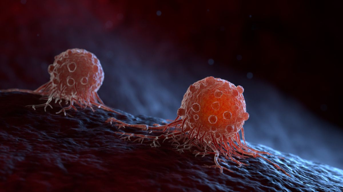 Cancro do Ovário: uma doença silenciosa 