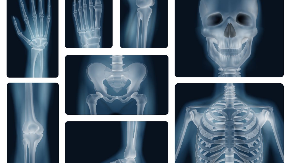 Dia Europeu da Radiologia: o papel fundamental da radiologia no diagnóstico precoce das crianças 